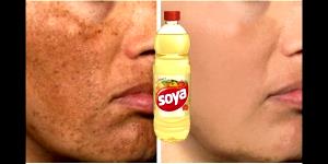 Quantas calorias em 1 Xícara Óleo de Soja?